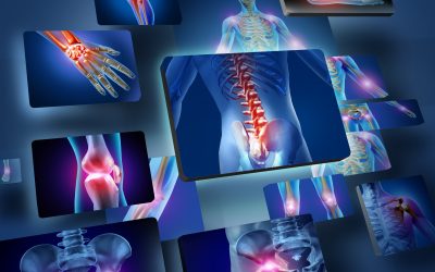 Physical Therapy Strategies for Addressing Sciatica in Conway, AR and Restoring Function