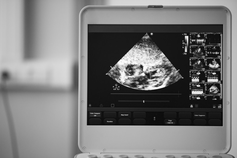 Doctors Are Using Portable Ultrasound Devices to Provide Better Care